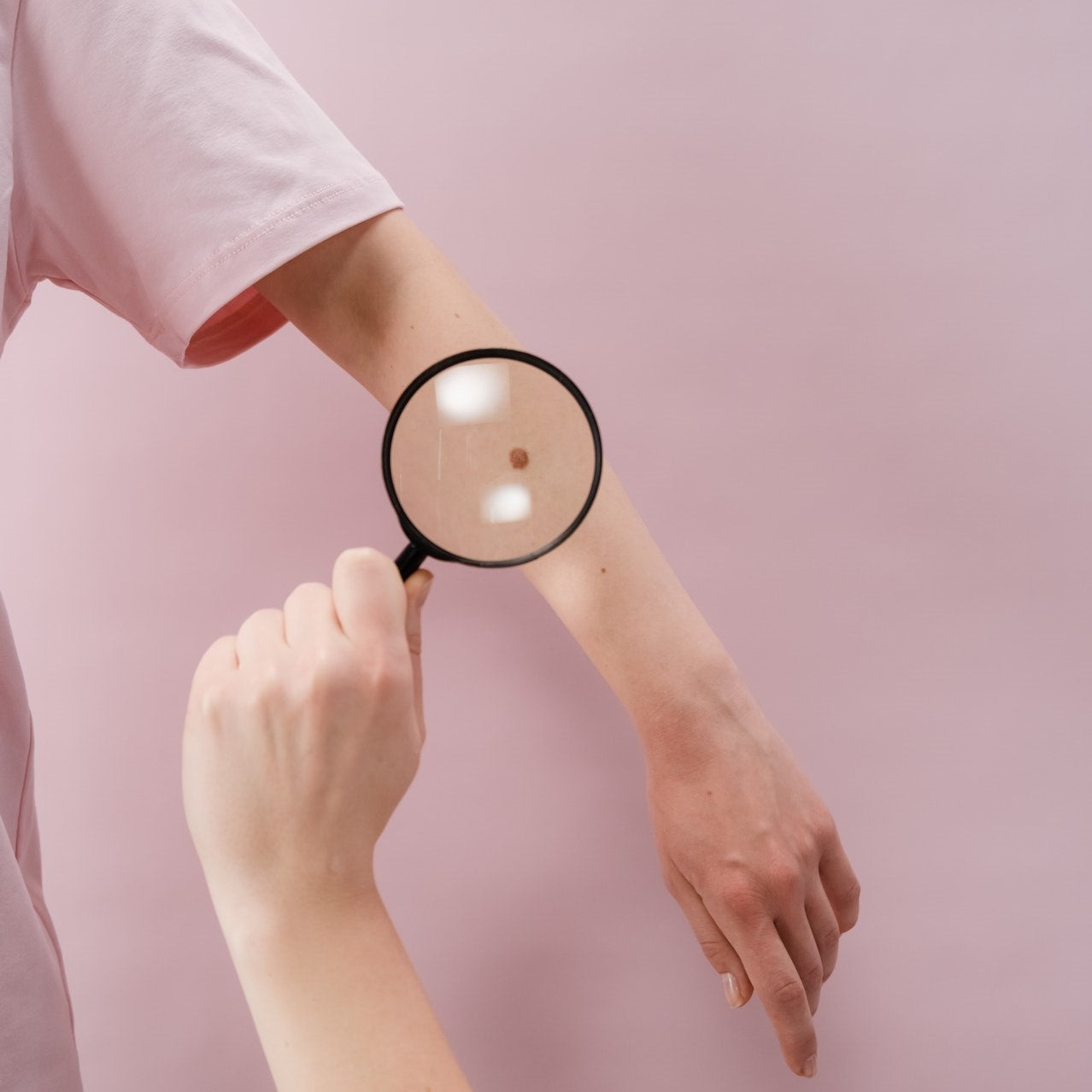 Eine Onkologin hält eine Lupe auf den Arm einer Patientin
